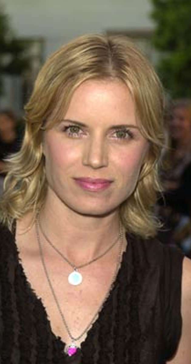 Kim Dickens Botox Plastic Surgery