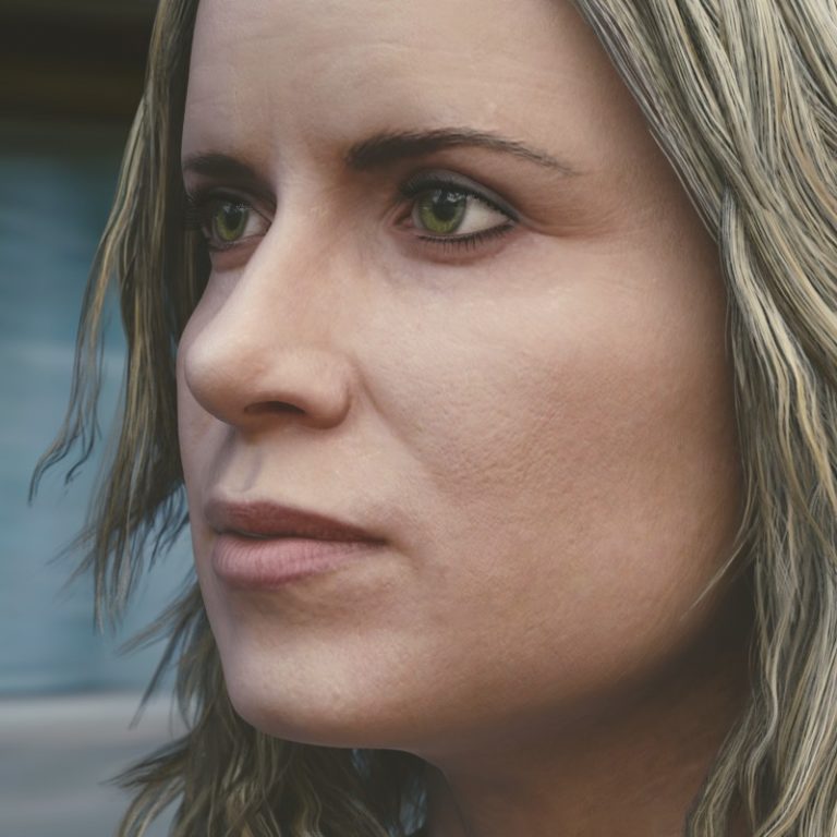 Kim Dickens Nose Job Plastic Surgery