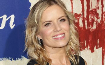 Kim Dickens Plastic Surgery Nose Job Boob Job Botox Lips