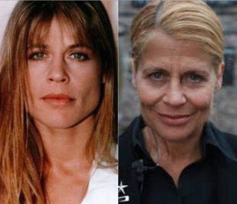 Linda Hamilton Nose Job Plastic Surgery