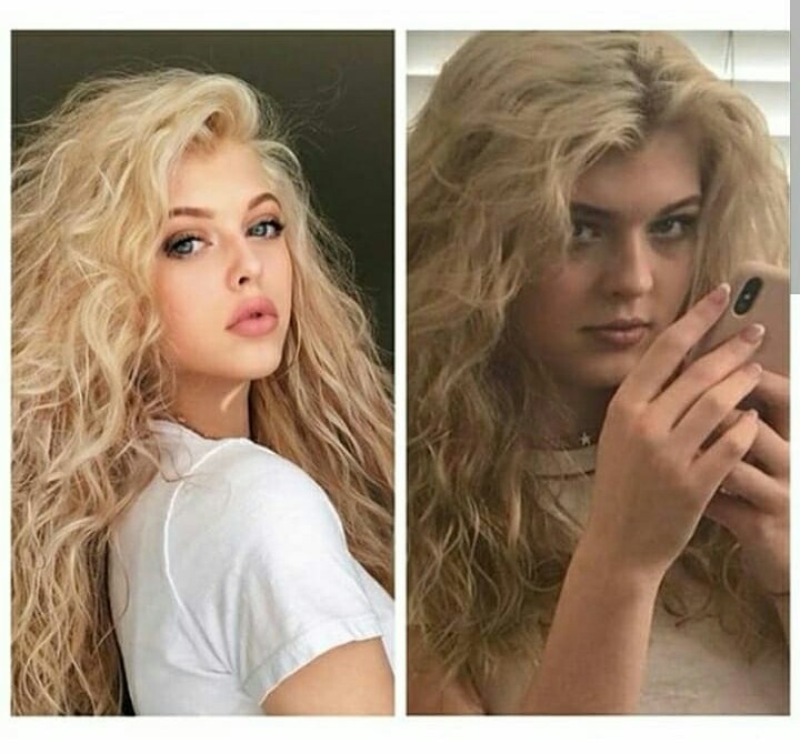 Loren Gray Nose Job Plastic Surgery