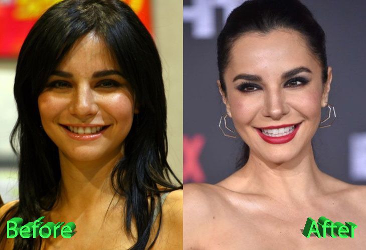 Martha Higareda Nose Job Plastic Surgery