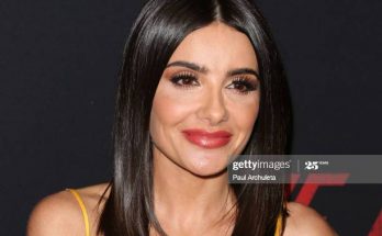 Mikaela Hoover Plastic Surgery Nose Job Boob Job Botox Lips