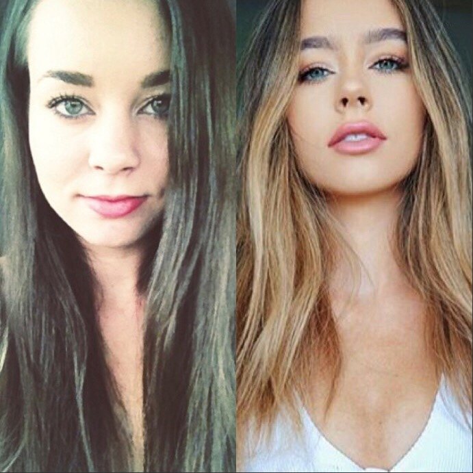 Sierra Furtado Nose Job Plastic Surgery