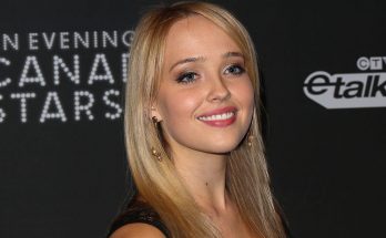 Siobhan Williams Plastic Surgery Nose Job Boob Job Botox Lips