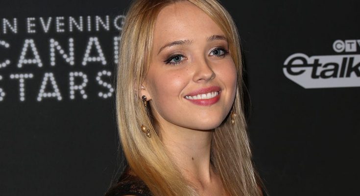 Siobhan Williams Plastic Surgery Nose Job Boob Job Botox Lips