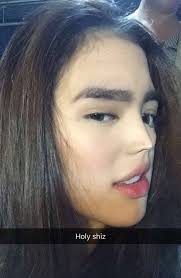 Sofia Andres Nose Job Plastic Surgery