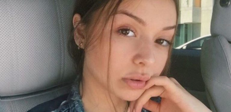 Sophie Mudd Lips Plastic Surgery