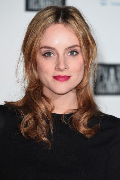 Sophie Rundle Botox Plastic Surgery