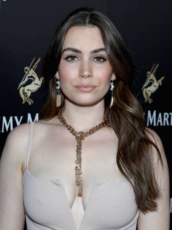 Sophie Simmons Botox Plastic Surgery