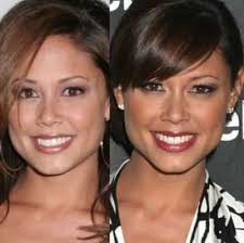 Vanessa Lachey Nose Job Plastic Surgery