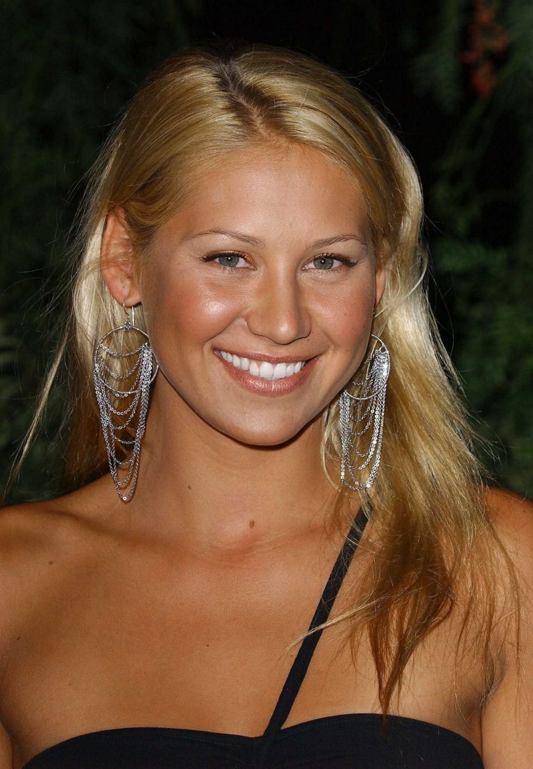 Anna Kournikova Botox Nose Job Lips Plastic Surgery Rumors