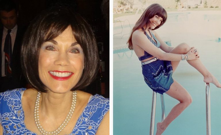 Barbi Benton Botox Nose Job Lips Plastic Surgery Rumors