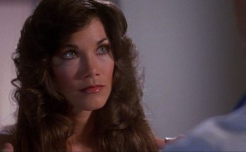 Barbi Benton Plastic Surgery Nose Job Boob Job Botox Lips