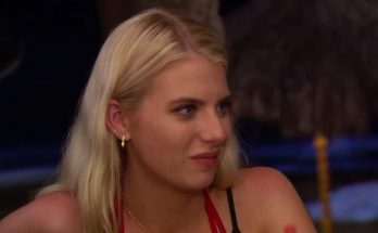 Haley Ferguson Plastic Surgery Nose Job Boob Job Botox Lips