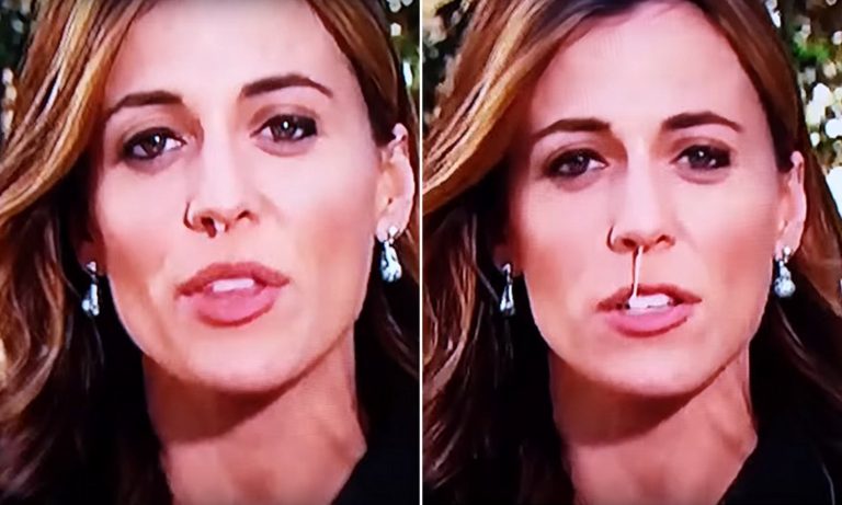 Hallie Jackson Botox Nose Job Lips Plastic Surgery Rumors