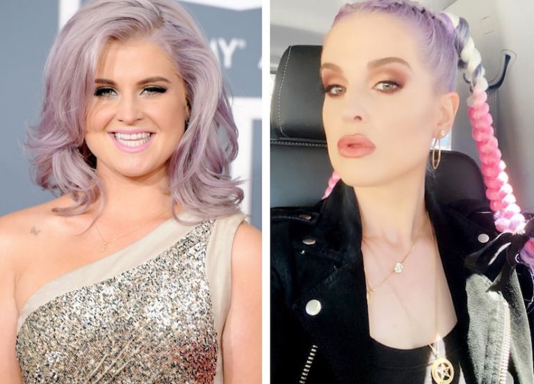 Kelly Osbourne Botox Nose Job Lips Plastic Surgery Rumors