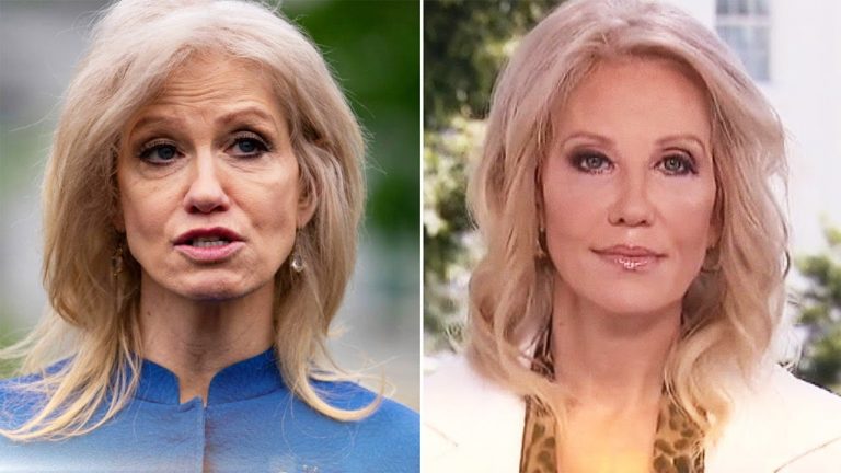 Kellyanne Conway Botox Nose Job Lips Plastic Surgery Rumors