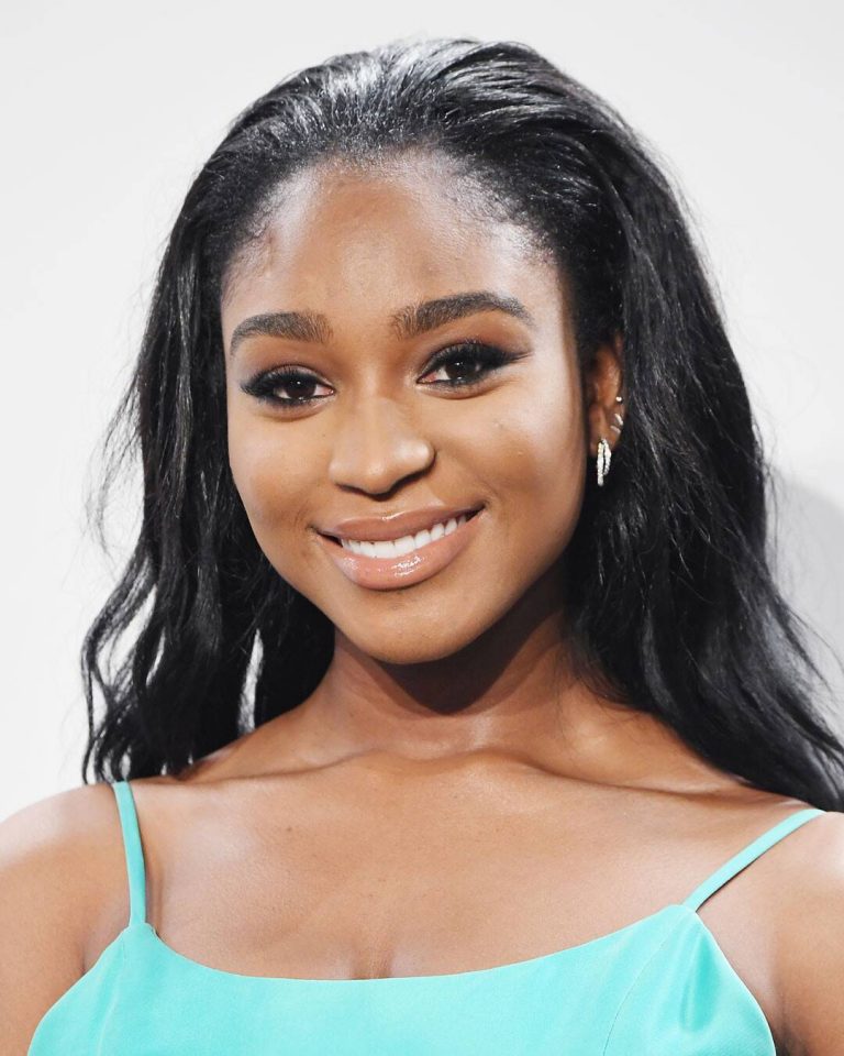 Normani Kordei Botox Nose Job Lips Plastic Surgery Rumors