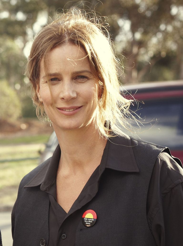 Rachel Griffiths Botox Nose Job Lips Plastic Surgery Rumors