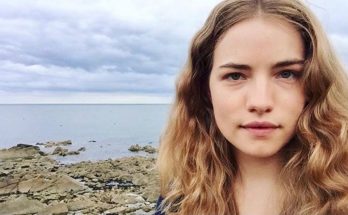 Willa Fitzgerald Plastic Surgery Nose Job Boob Job Botox Lips