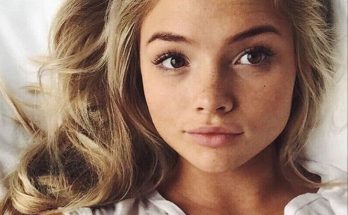 Natalie Alyn Lind Plastic Surgery