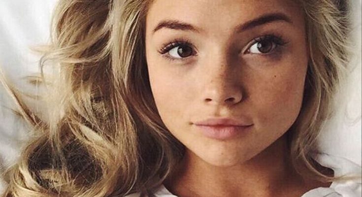 Natalie Alyn Lind Plastic Surgery