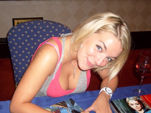 Sheridan Smith Cosmetic Surgery Face