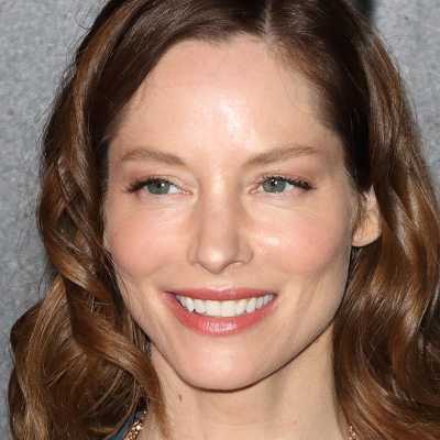 Sienna Guillory Plastic Surgery Face