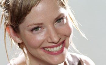 Sienna Guillory Plastic Surgery and Body Measurements
