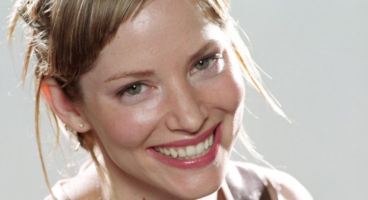 Sienna Guillory Plastic Surgery and Body Measurements