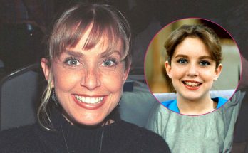 Dana Plato Plastic Surgery