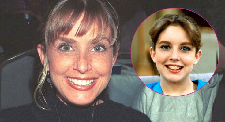 Dana Plato Plastic Surgery