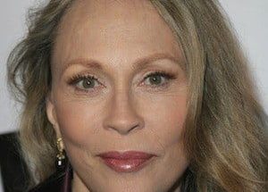 Faye Dunaway Plastic Surgery Procedures