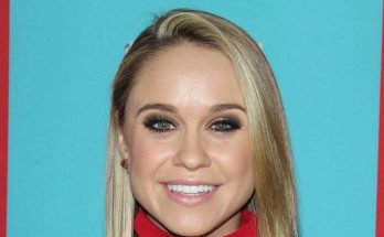 Becca Tobin Botox and Fillers