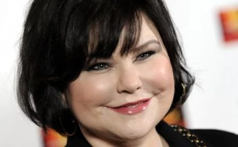 Delta Burke Plastic Surgery