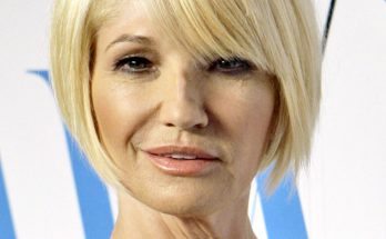 Ellen Barkin Plastic Surgery Procedures