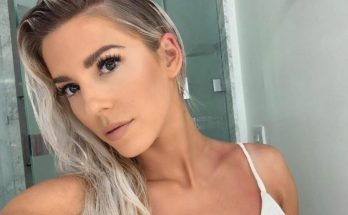 Heidi Somers Botox, Fillers, and Lips