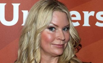 Jackie Siegel Plastic Surgery Procedures