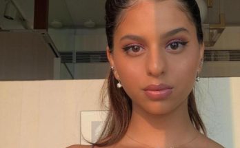 Suhana Khan Cosmetic Surgery