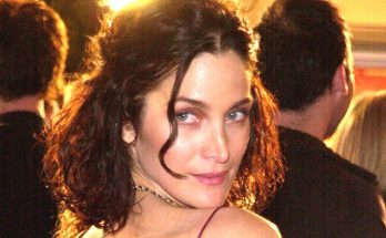 Carrie-Anne Moss Plastic Surgery Procedures