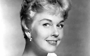 Doris Day Plastic Surgery Procedures