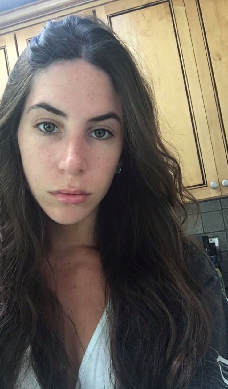 Jen Selter Cosmetic Surgery Face