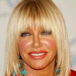 Suzanne Somers Plastic Surgery Procedures