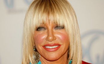 Suzanne Somers Plastic Surgery Procedures