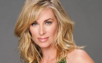 Eileen Davidson Plastic Surgery