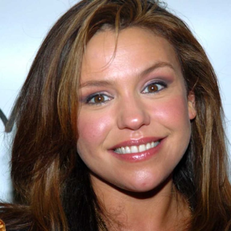 Rachael Ray Cosmetic Surgery Face