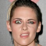 Kristen Stewart Cosmetic Surgery