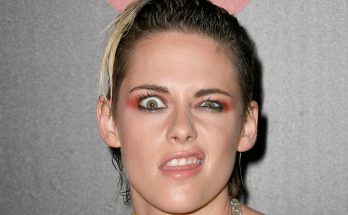 Kristen Stewart Cosmetic Surgery