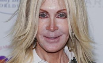 Joan Van Ark Plastic Surgery